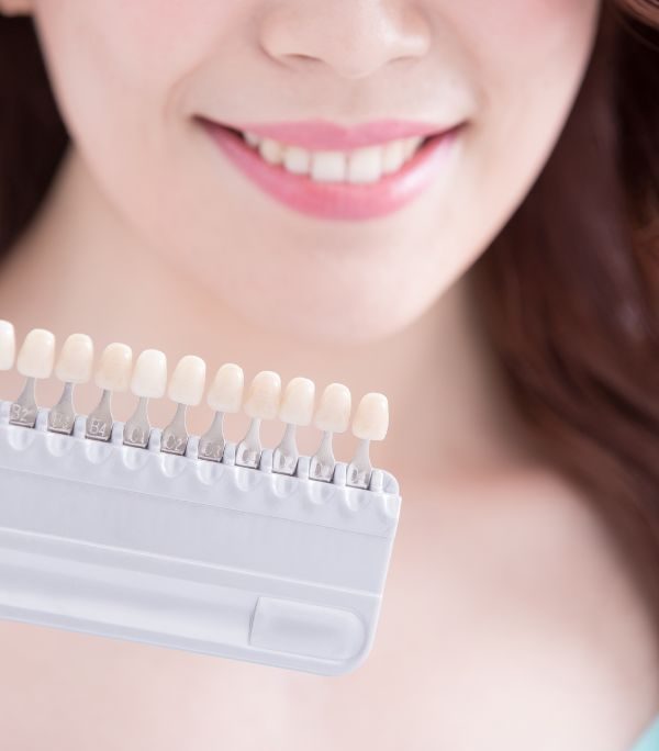 Tooth Whitening Dentist in Woodbury, MN